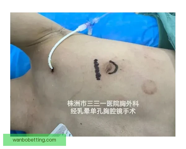 坎宁安气胸康复持续推进 活塞计划一周后复查评估 坎宁安气胸康复持续推进 活塞计划一周后复查评估
